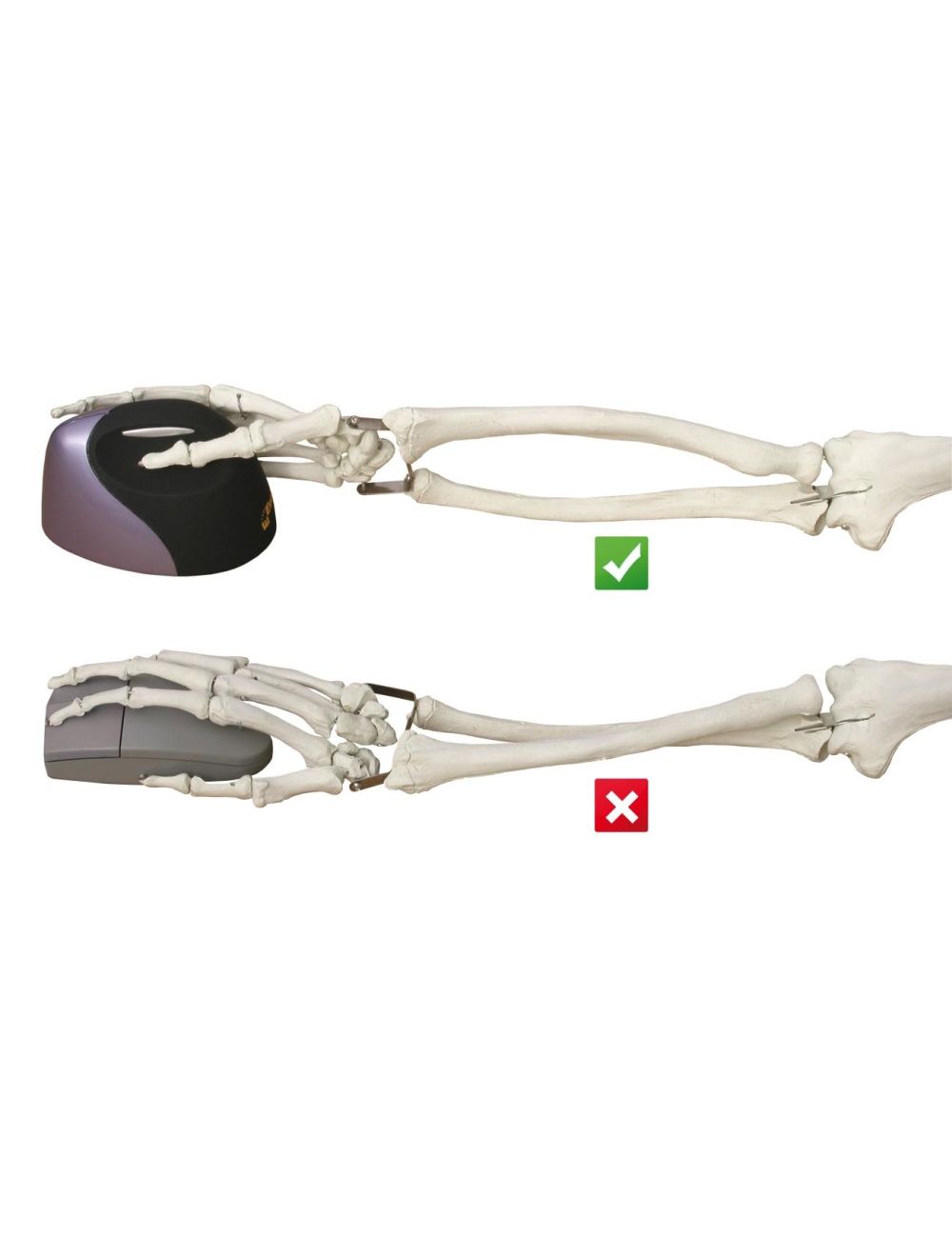 Evoluent VerticalMouse 4 Rechts Drahtlos