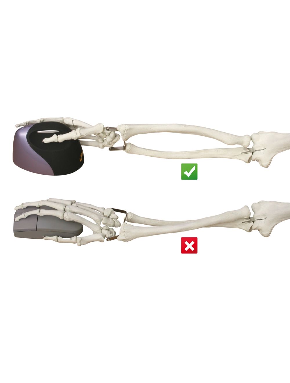 Evoluent VerticalMouse 4 Rechts